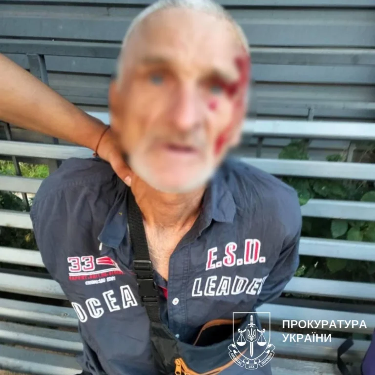 У Києві затримали 60-річного рецидивіста за зґвалтування та розбійні напади на жінок