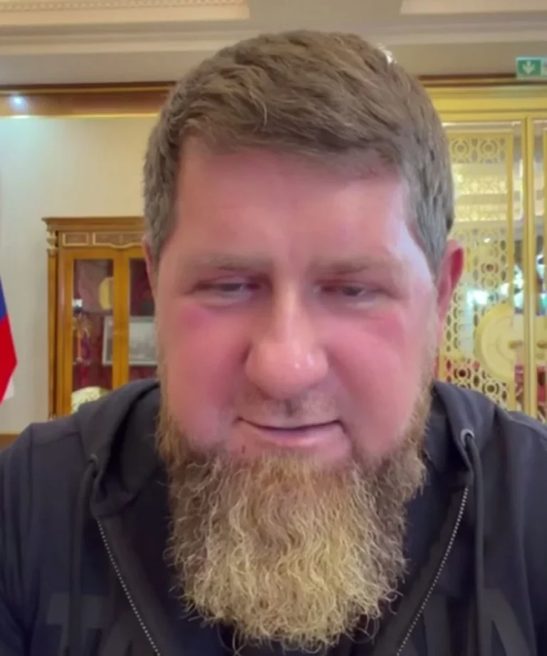 кадиров обіцяє “жорстку відповідь” Україні після атаки дрона на грозний