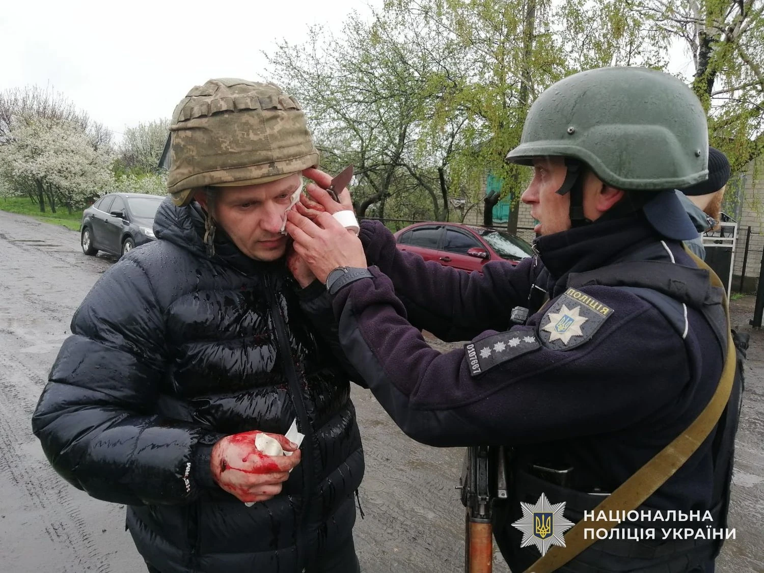 На Дніпровщині чоловік підірвав гранату під час затримання, поранено 5 поліцейських